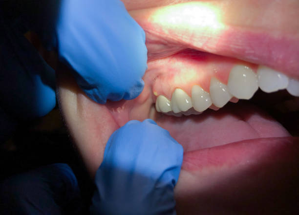 Best 24-Hour Emergency Dentist in March Ar, CA